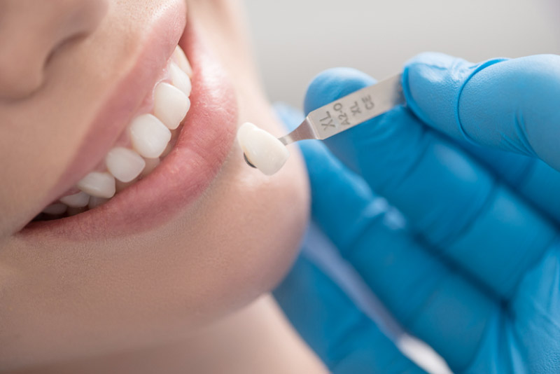 Bọc Răng Sứ Có Đau Không? Nên Đến Nha Khoa Nào Bọc Răng Để Đảm Bảo An Toàn