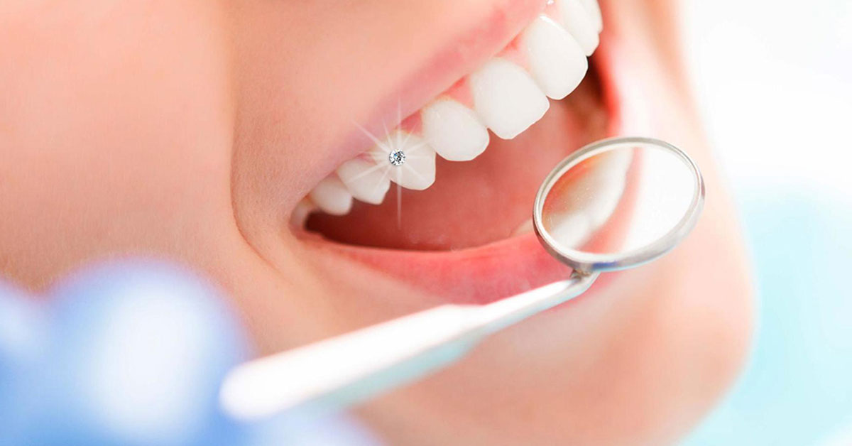 Nha Khoa Ngọc Trai | Răng Bị Sâu Có Bọc Răng Sứ Được Hay Không?