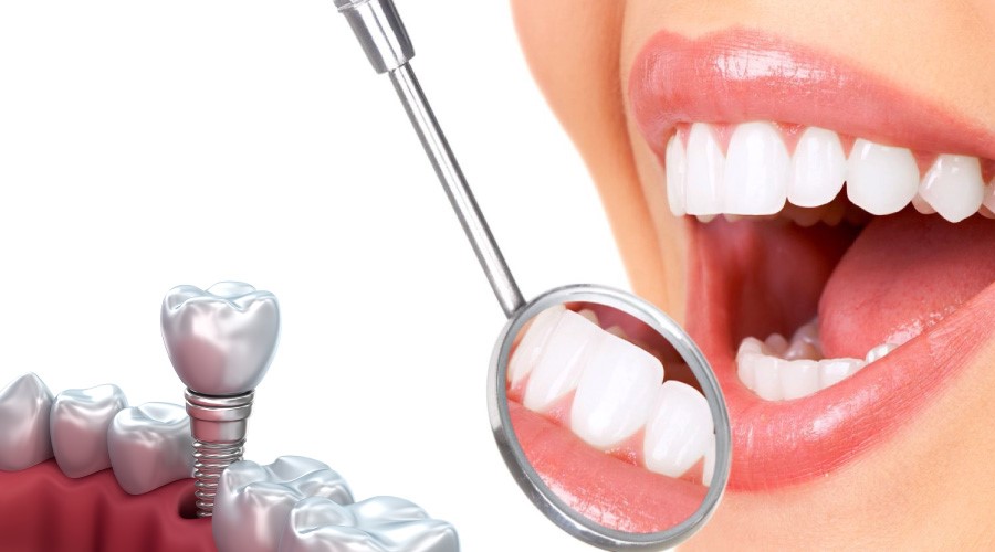 Nha Khoa Ngọc Trai | Khi Nào Trồng Răng Implant Là Tốt Nhất?