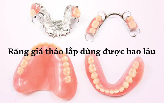 Rang Gia Thao Lap Dung Duoc Bao Lau