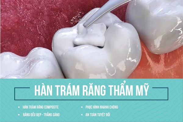Tram Rang Tham My Gia Re Tai Hai Duong 4