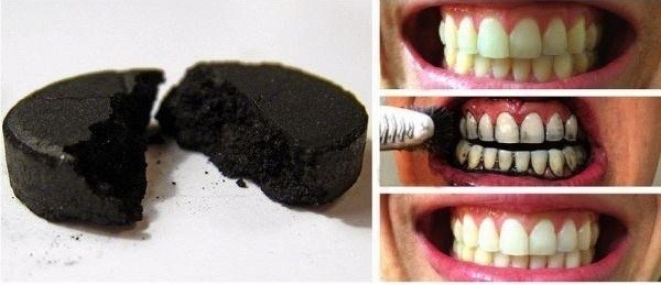 Các cách làm trắng răng tự nhiên với than hoạt tính
