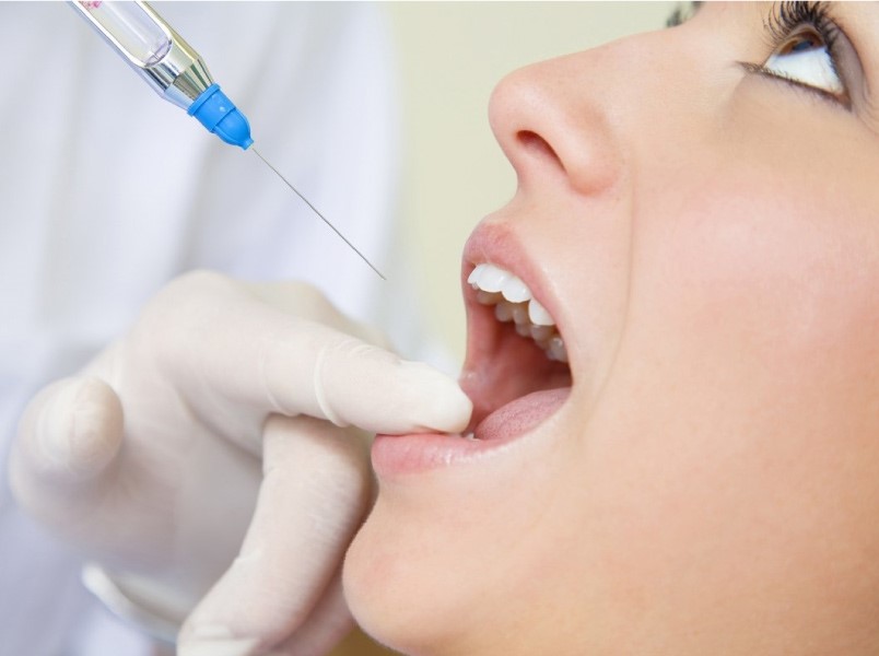 Chăm sóc răng sứ tại nhà như thế nào là hiệu quả nhất?