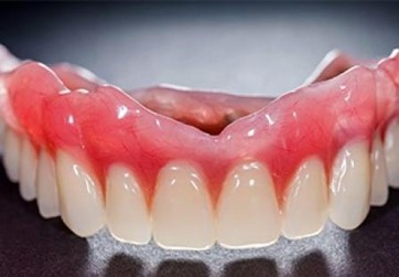 Làm phương pháp răng giả tháo lắp nhựa dẻo có tốt không?