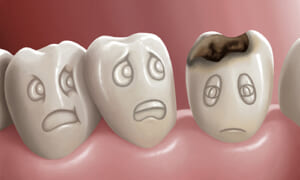 Nha khoa Ngọc Trai | Bị sâu răng ảnh hưởng đến sức khỏe như thế nào?