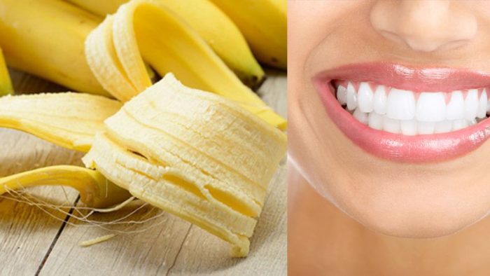 Nha khoa Ngọc Trai | Có nên tự làm trắng răng tại nhà hay không?