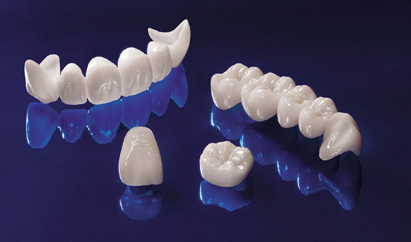 Nha khoa Ngọc Trai | Làm răng sứ lần 2 có đau không?
