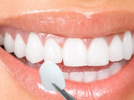 Nha khoa Ngọc Trai | Mài răng để làm răng sứ có nguy hiểm hay không?