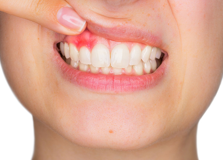 Những biến chứng thường gặp khi cấy ghép răng implant giá rẻ