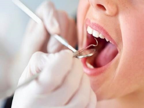 Những điều bạn cần biết trước khi thực hiện tẩy trắng răng