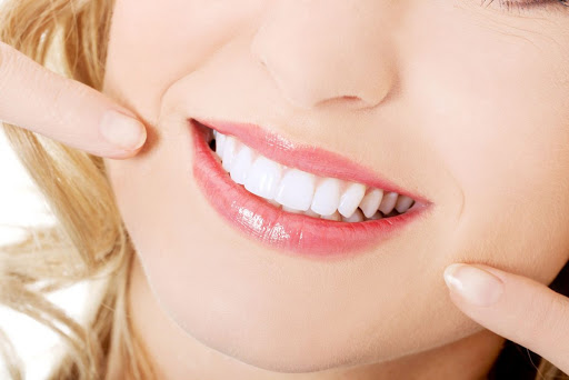Những điều bạn cần biết về bọc răng sứ thẩm mỹ