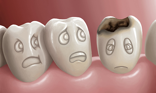 Tại sao bọc răng sứ bị hôi miệng? – Cách xử lí sao cho hiệu quả
