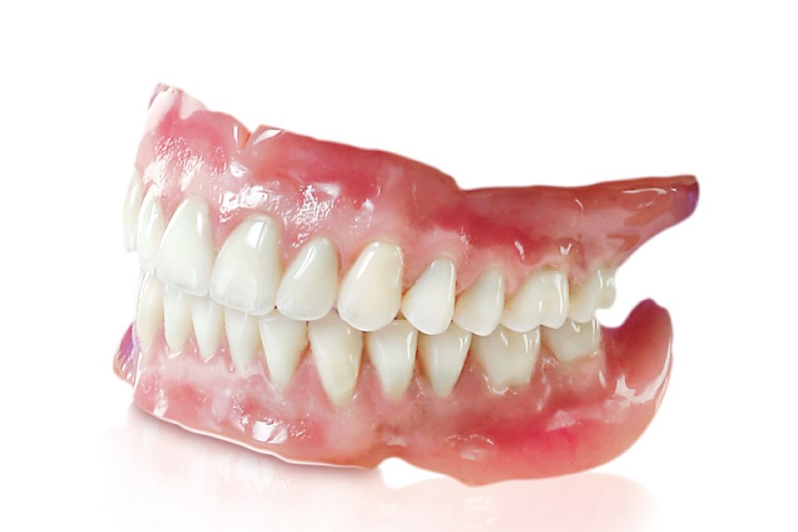 Tổng hợp những ưu điểm của phương pháp trồng răng giả tháo lắp