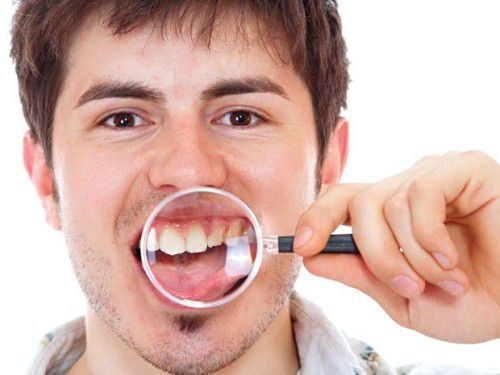 Trồng răng sứ thẩm mỹ cho răng thưa như thế nào là tốt nhất?